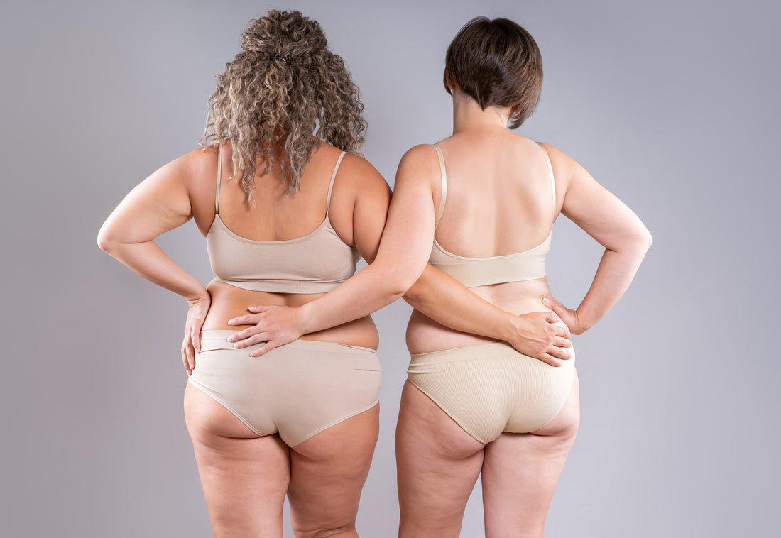 Le lien entre stress, hormones et cellulite : ce qu’on t’a jamais dit